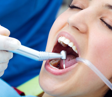 Diş Eti Hastalıkları ve Tedavisi