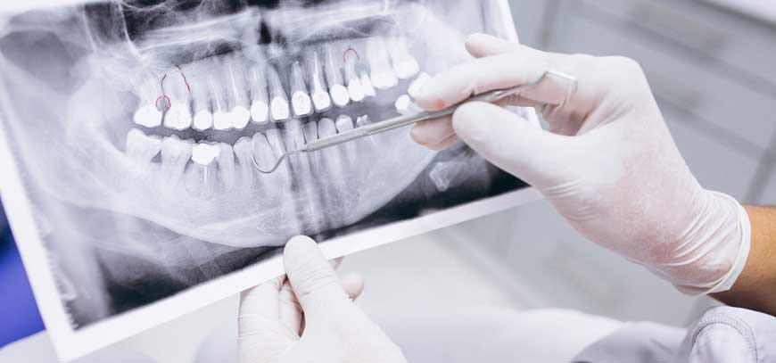 Oral Diagnoz ve Radyoloji