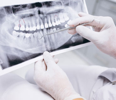 oral diagnoz ve radyoloji